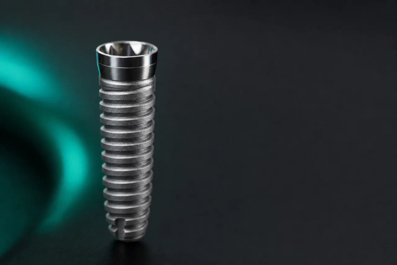 Implantat oder Brücke: Vergleich, Vorteile und die richtige Entscheidung für Ihren Zahnersatz